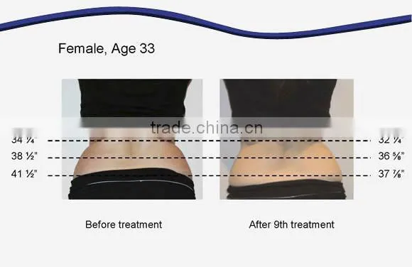 multifunctional lipolaser cavitation rf beauty machine / laser rf skin treatment machine