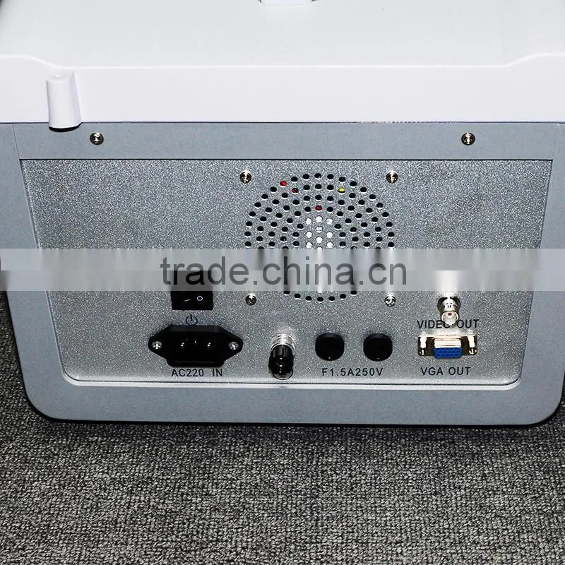 Low cheap portable Ultrasound Scanner 10 inch optional video thermal recorder