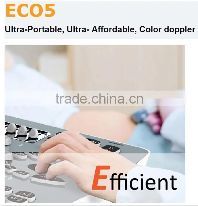 China cheap price USB portable laptop color doppler ultrasound scanner for pregnancy scanner ultrasound