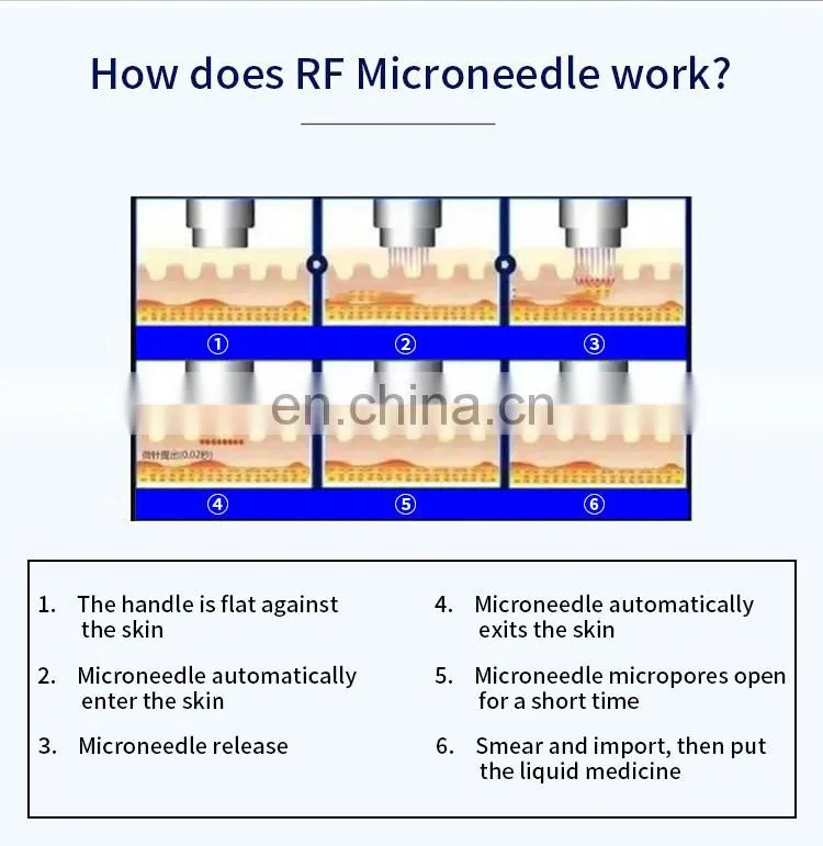 Gold RF Fractional Microneedle Machine Lifting Scars Wrinkles Remove Whitening Instrument Beauty Salon Skin Tightening Device