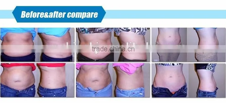 CE approved 5 in 1 weight loss mono polar ultrasound slimming skin tightening