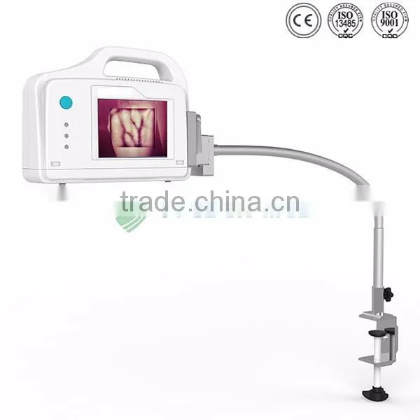 medical injection portable vein viewer price