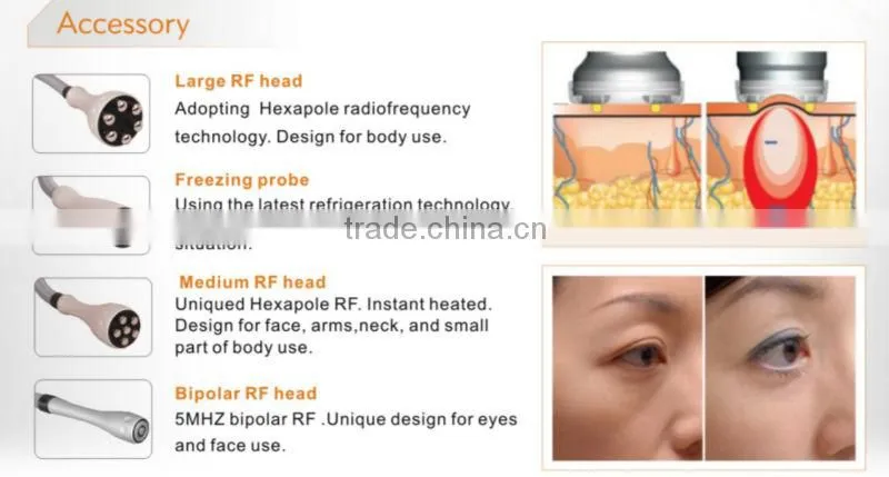 anti-aging medical multipolar RF body slimming machine 2014