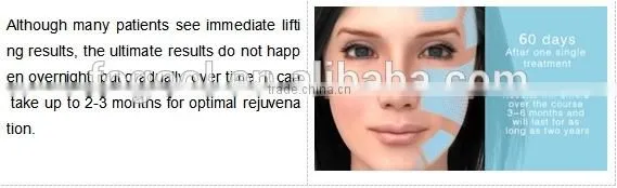 Portable Ultrasound Machine High Quality HIFU Face Lift