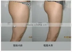 ultrasound fat burning machine for home use tm-jk268