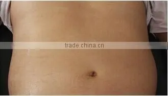 LM-S600P Cool Tech Fat Freezing Machine Cryo Slimming Liposuction Machine