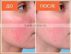 2016 Newest 2 handles OPT SHR IPL hair removal equipment/IPL SHR /3000W high power shr ipl machine