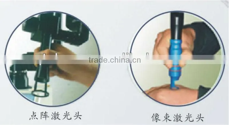 Ultra impulse CO2 fractional laser treatment device
