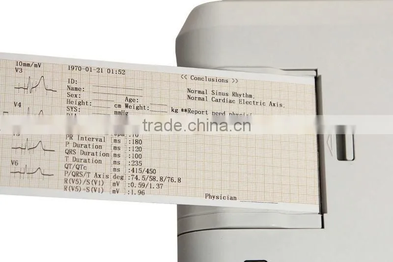 CE&ISO Best Price Color Screen Medical Equipment 3 Channel Electrocardiograph ECG Machine with Software EKG Machine-903BS-Shelly