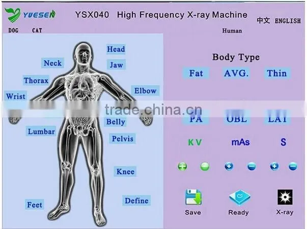Medical X-ray scanner portable xray machine