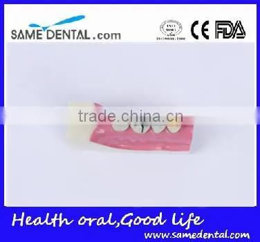 Right Tooth Tissue Decomposition Model Dental Eduction Assitant No. DEA-17