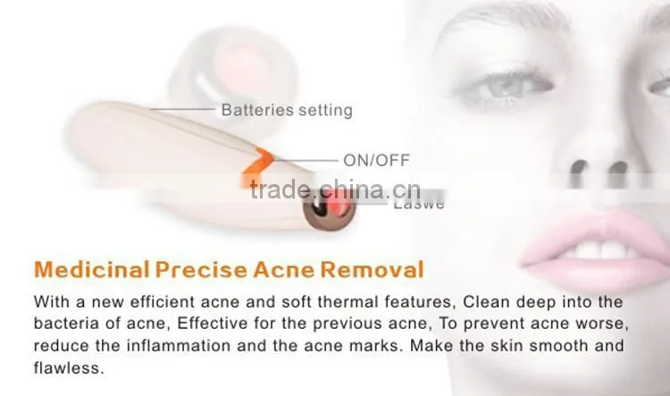 Best effective hot sale soft acne laser removal/acne treatments pen for sale