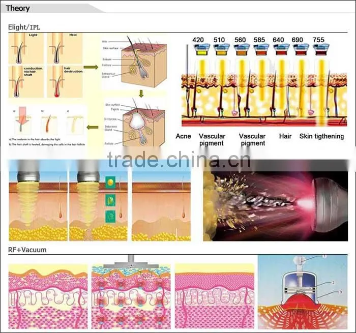 2016 portable 6 in 1 ultrasound beauty equipment for rf fractional cavitation