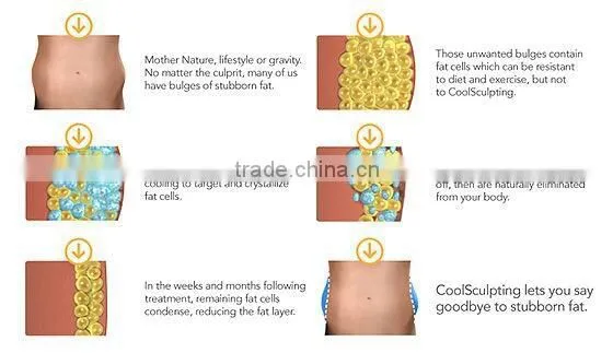 Newest body shaping and skin tightening multi-functional slimming machine(JB-8500)