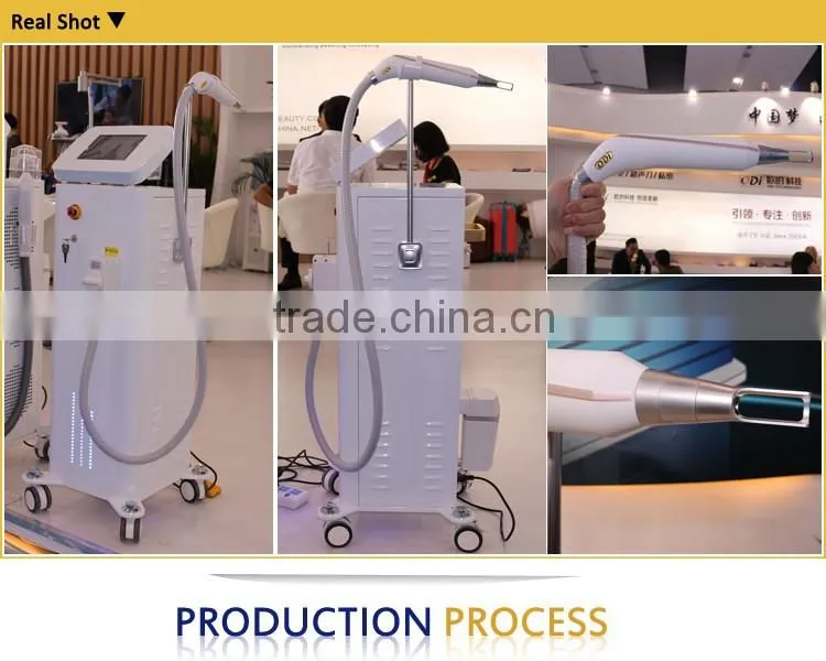 Best laser tattoo treatment machine nd yag tattoo removal laser machine