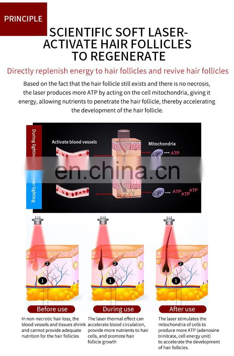 650nm Diode Laser SPA Scalp Treatment Machine with Hair Analysis Camera Professional Hair Regrowth Machine for Hair Salon