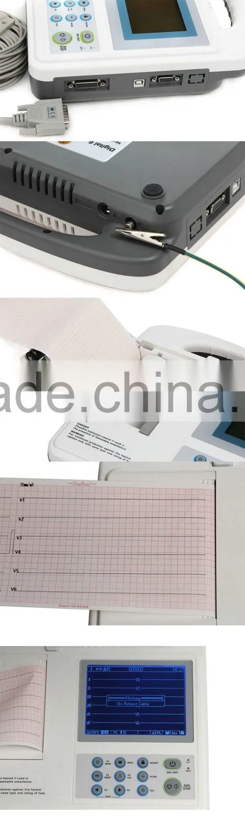 Portable Digital 6-channel Electrocardiograph ECG Machine EKG Machine-EKG-1206-Shelly