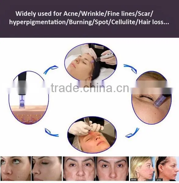 Auto derma pen dr pen microneedle machine with CE approval