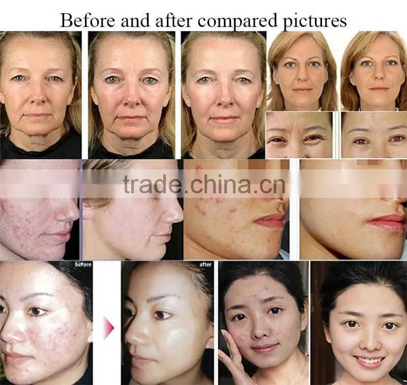 NEW!! home use diamond micro crystal dermabrasion microderm skin system