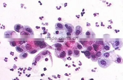 Lactobacillus smearLactobacillus smear Individual microscope prepared slide