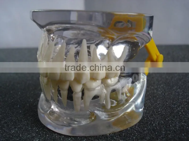 Transparant deciduous Teeth Model Teaching And Hospital Demonstration