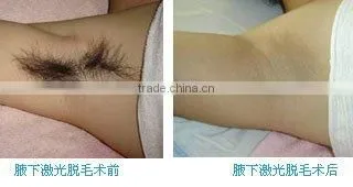 IPL Medical Beauty equipment