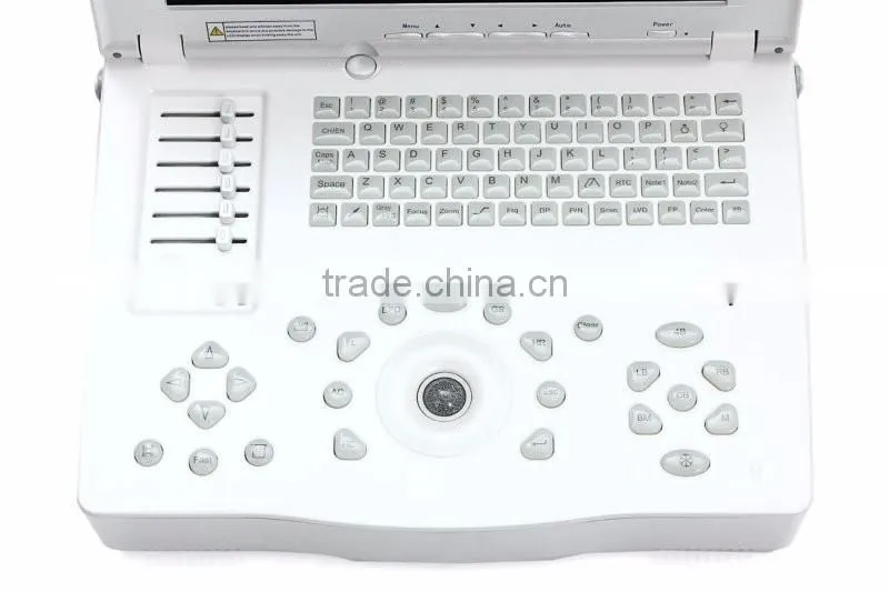 Hospital clinical equipment 15-inch full digital Laptop Ultrasound Scanner China made portable ultrasound machine