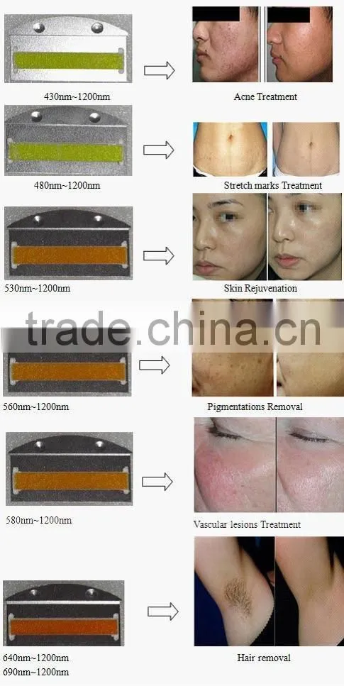 To make you perfect product mini ipl for hair removal-on promotion