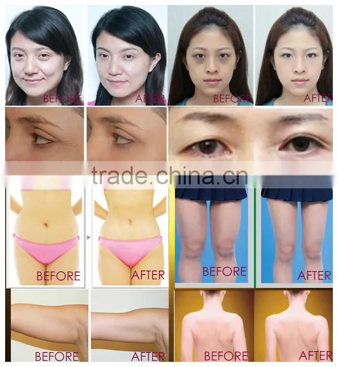 Skin rejuvenation Microcurrent Facial Wrinkle Removal Device