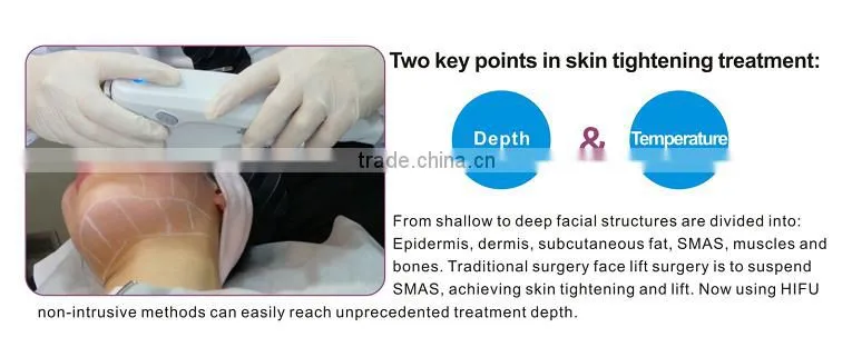 high intensity focused ultrasound surgery of the future