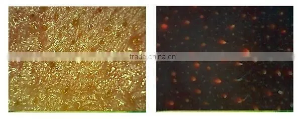 AYJ-J016 skin ance blackhead wrinkle microscope