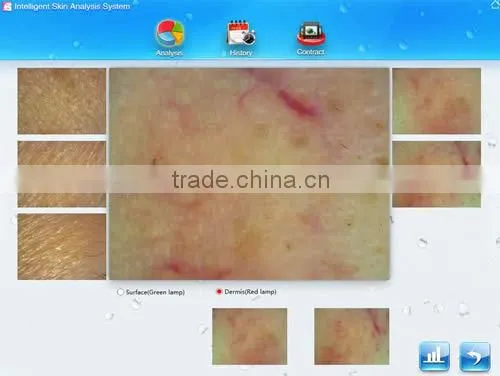 2014 hot sale salon furniture portable skin analyzer/ facial skin analyzer