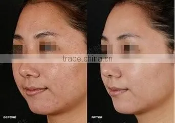 Hot Korea new product led mask 7 colors led skin rejuvenator mask for clinic or salon use