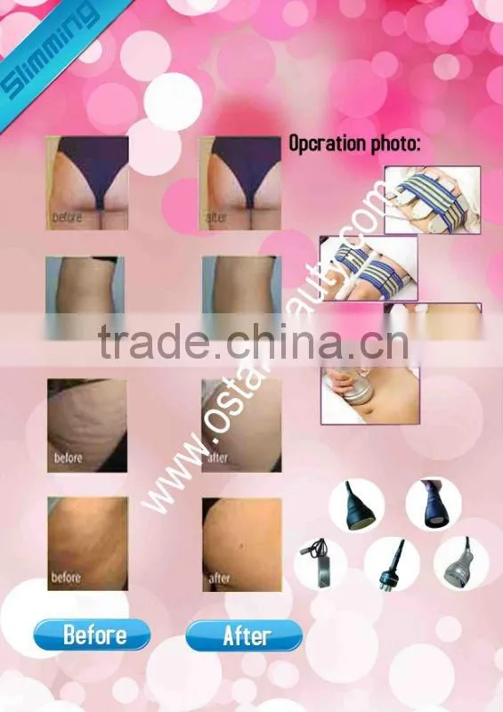 High-end magic weight loss lipolysis cavitation fat removal machines OB-SRN 05C