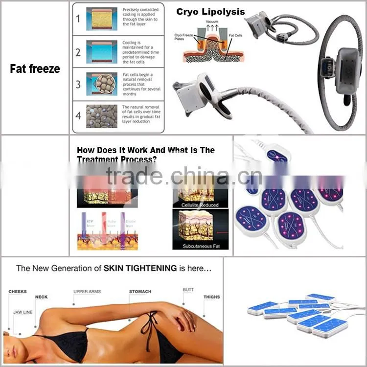 2015 new health and beauty anti cellulite massager fat reducing slimming