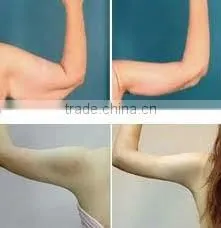 Amazing cellulite cracking effect!! Ultrasonic RF Cavitation Ultrasound Slimming Machine F006