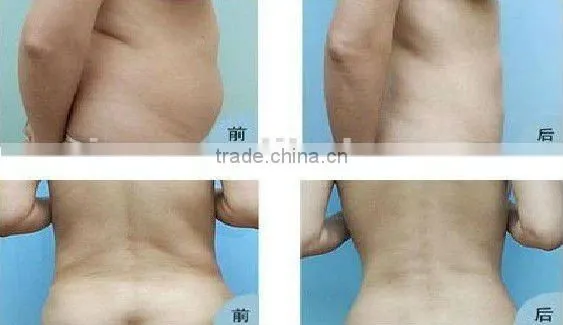 VY-M4 2014 Fat loss RF beauty machine keyword cavitation slimming machine