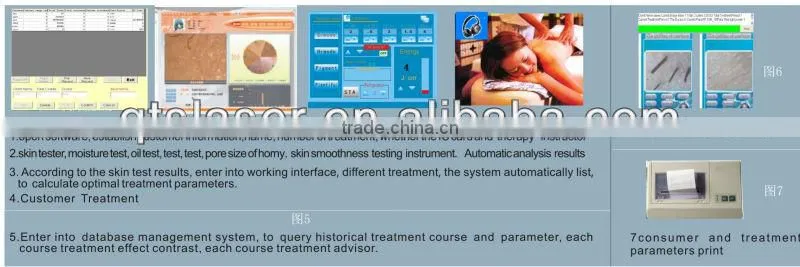 Multi-Function Beauty Equipment 4 in 1 E Light/ IPL RF/ Laser/Skin Analyzer