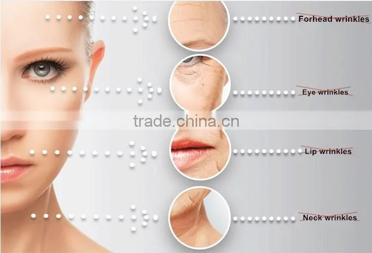 2017 Hot sale home use New Mini Hifu machine anti-wrink skin tightening wrinkle removerfor beauty