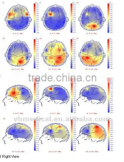 EEG device 24-channel portable machine
