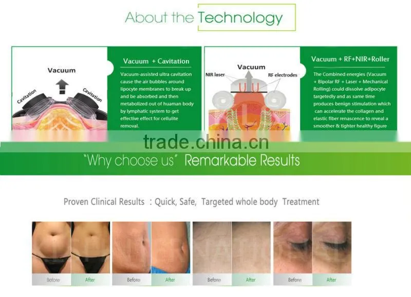 hot sell beauty salon professional microcurrent beauty salon machine