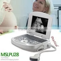 3D Color Doppler Ultrasound Machine with touch screen with competitive price MSLCU22-N