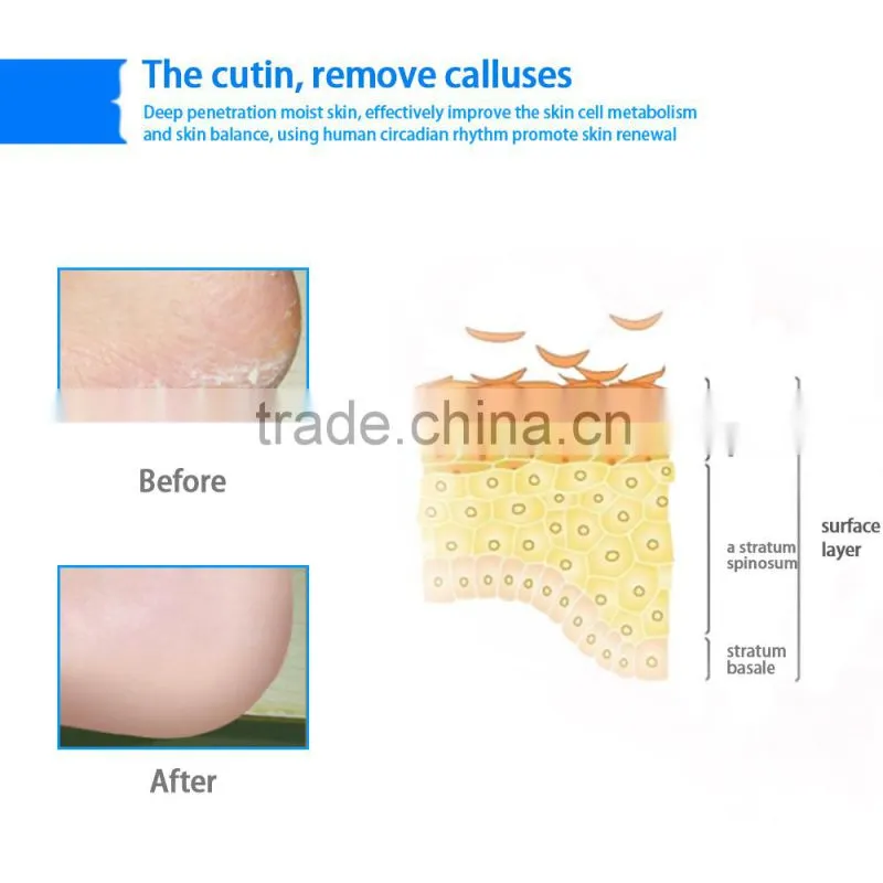 Professional foot care silicone gel heel pad protector