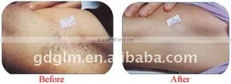 E-light (IPL +RF ) quantum hair removal beauty machine E-006