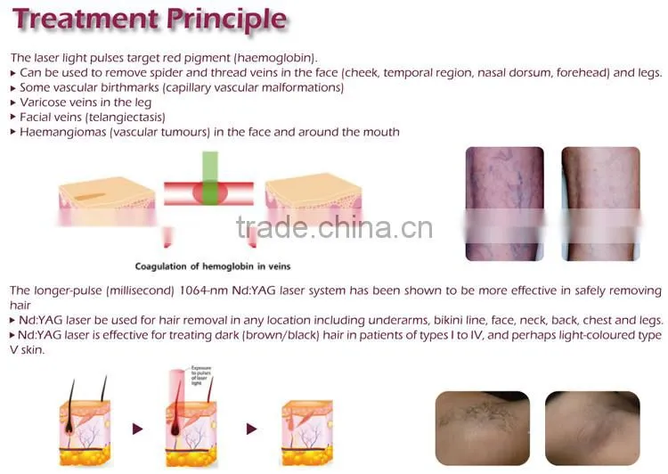 Korea original logo customized supported loading interface 7 joints arm q laser tattoo removal machine