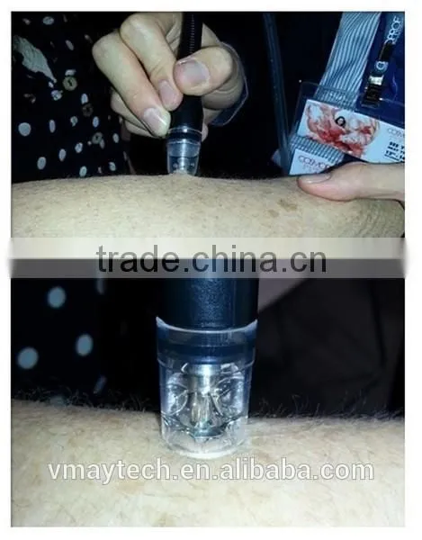 Portable Diamond Dermabrasion Machine / Hydra Microdermabrasion Facial Machine SPA9.0