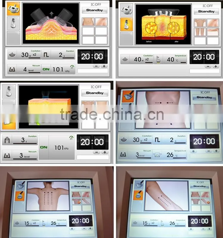 Advanced body slimming cavitation ultrasound beauty machine