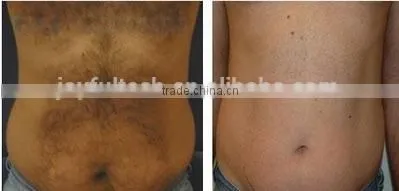 808nm diode laser high voltage power supply hair removal machine
