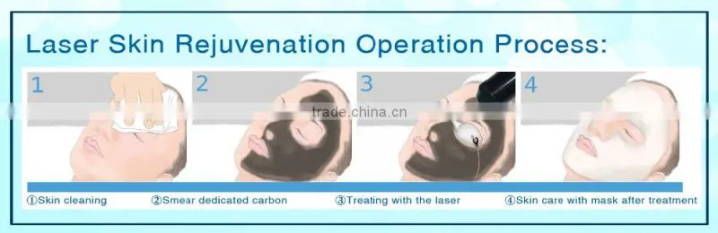 F6 Discount. Single Pulse 800mj Smart Laser Guiding Arm Movable Screen Active Laser Tattoo Removal 10Hz