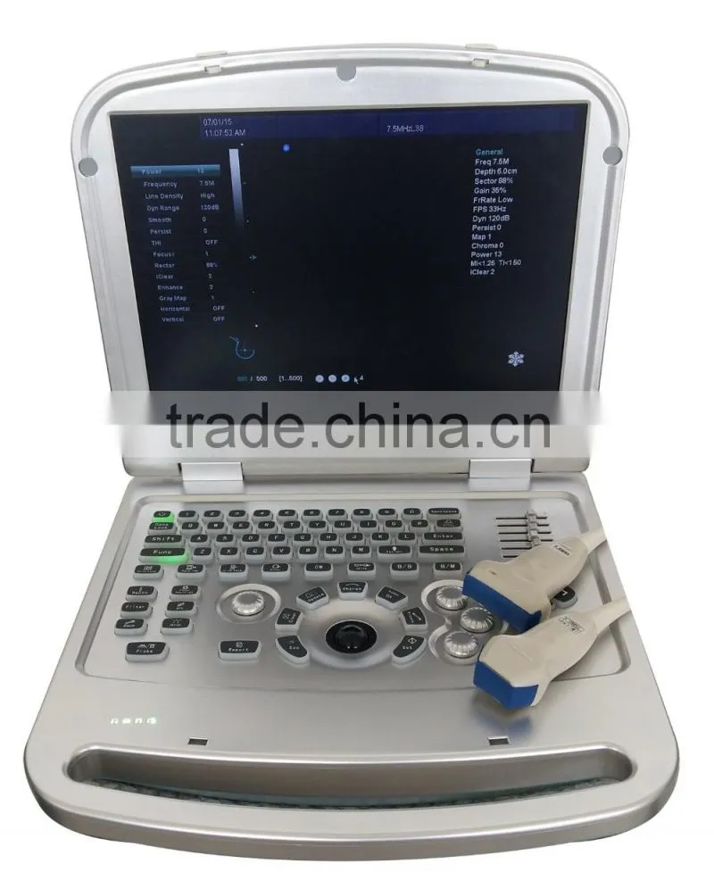15 inch laptop Color Doppler 64G image-storage capacity ultrasound scanner for hospital